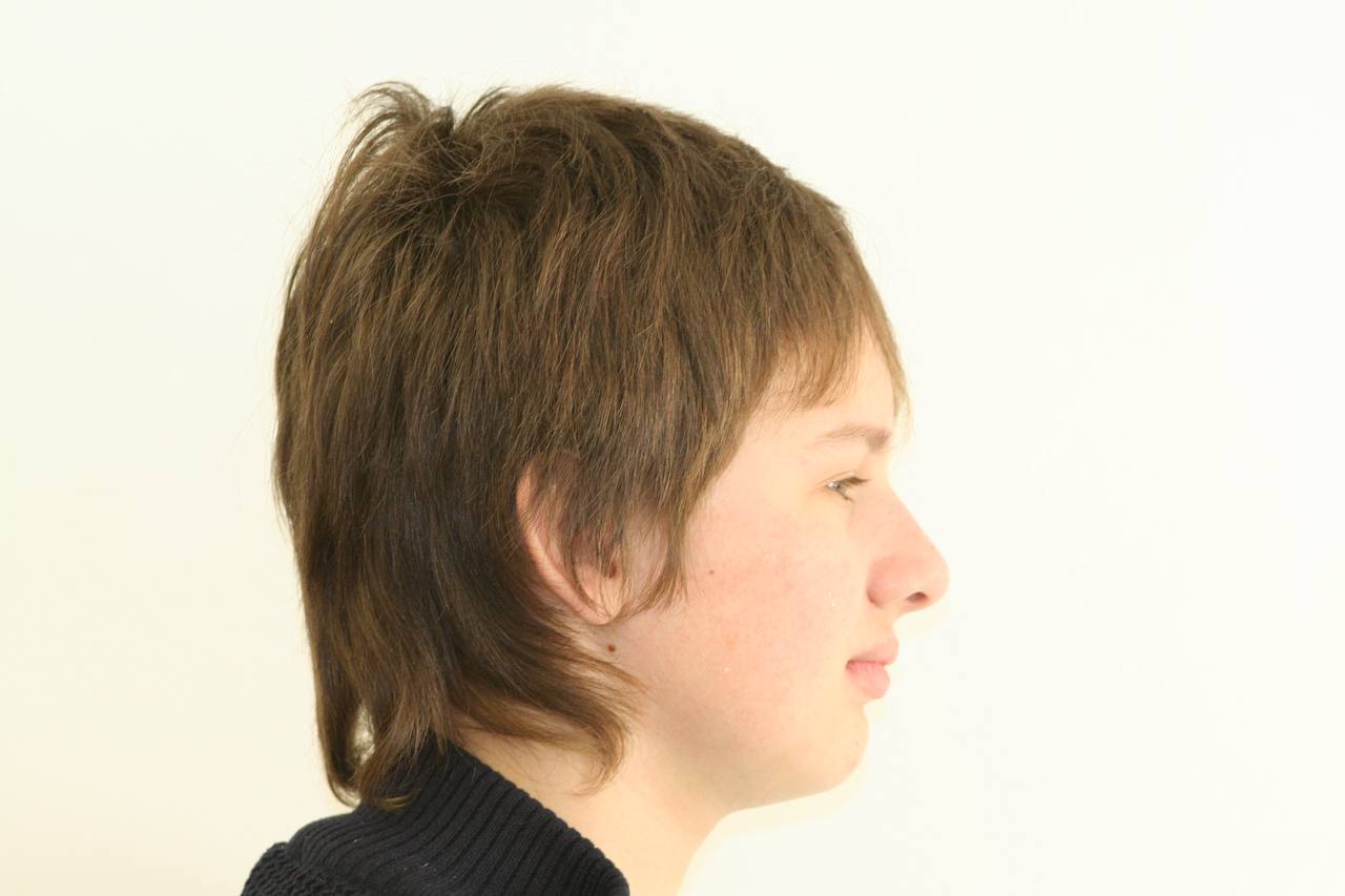 После лечения