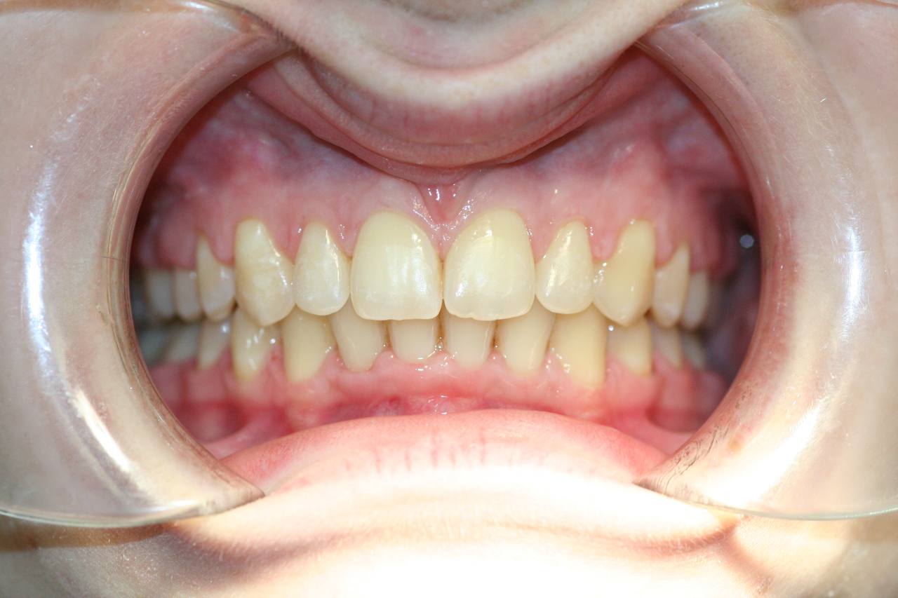 После лечения